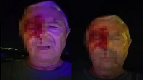 Görevi Başındaki Muhabire Yumruklu Saldırı