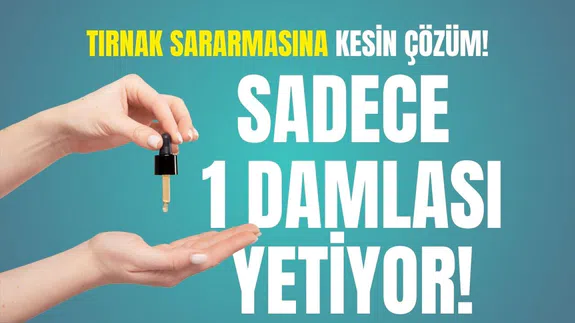 Sadece 1 damlası yetiyor! Tırnaklardaki sararmayı anında yok ediyor