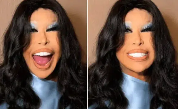 Bülent Ersoy Estetik Sonrası İlk Kez Sahneye Çıktı