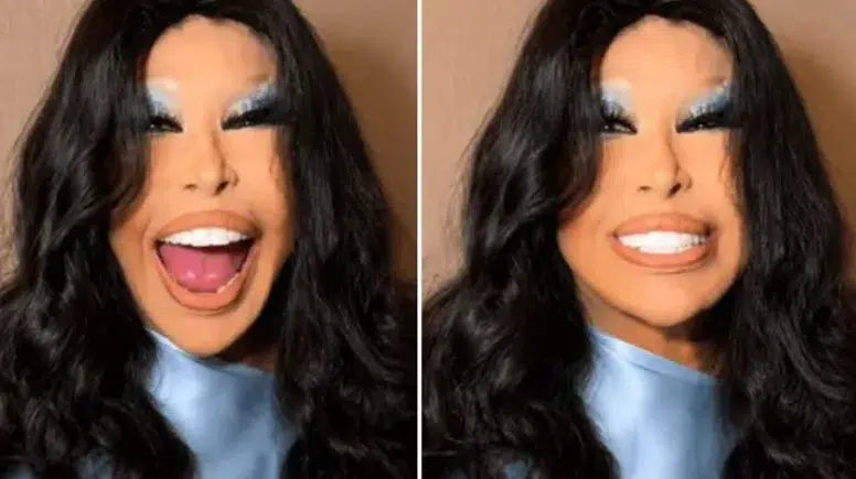 Bülent Ersoy Estetik Sonrası İlk Kez Sahneye Çıktı