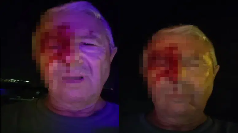 Görevi Başındaki Muhabire Yumruklu Saldırı