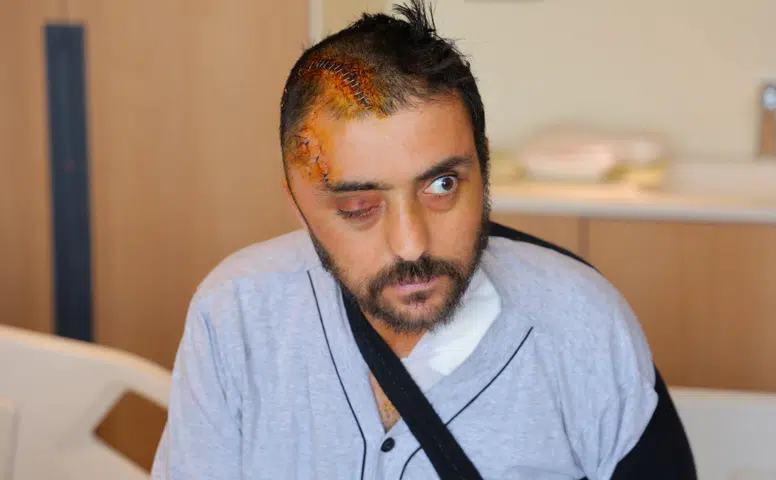 Kahramanmaraş’ta Aracına Kaya İsabet Eden Sürücü Ameliyatla Sağlığına Kavuştu