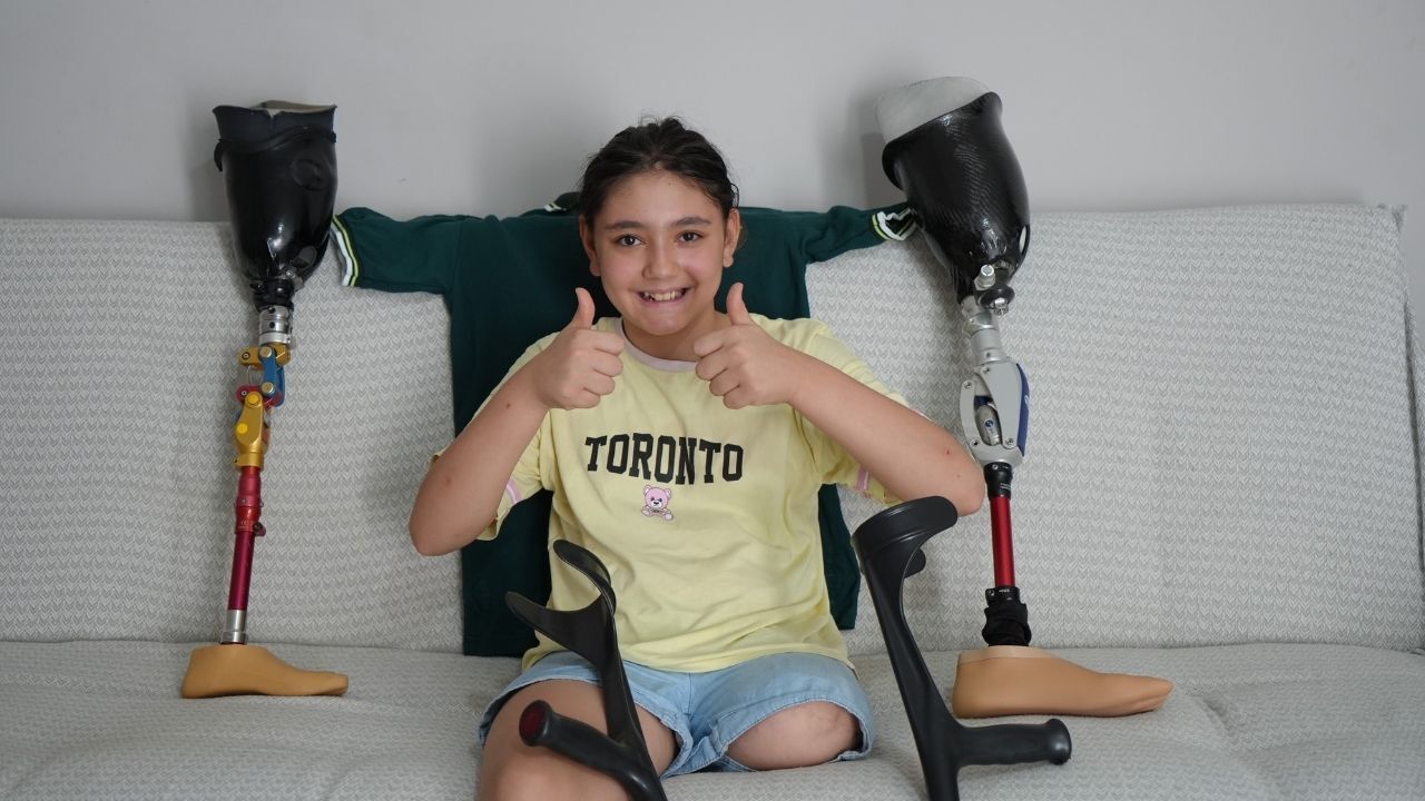 Protez Bacaklı Kız 1