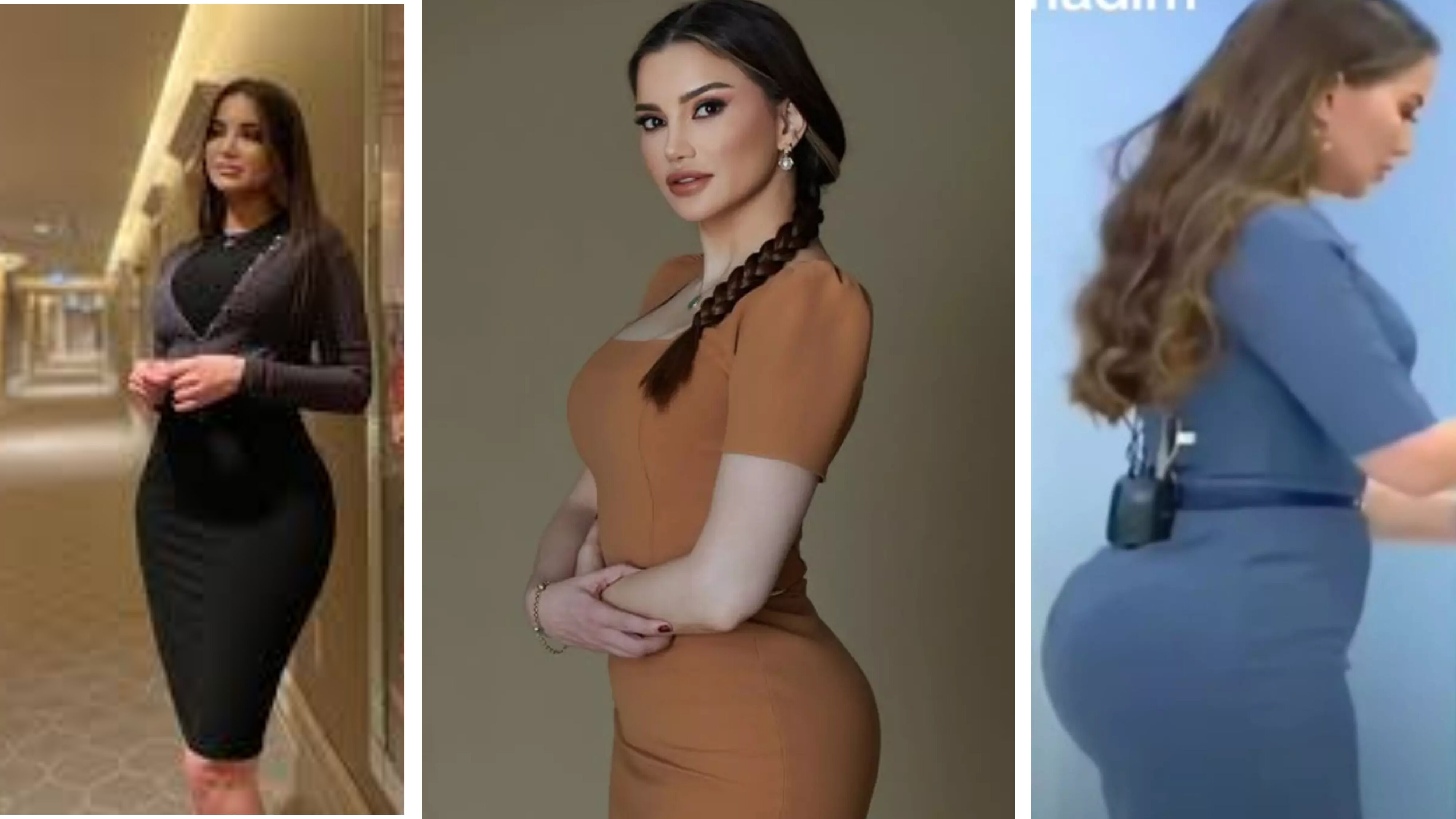 Esra Ezmeci'den Estetik İddialarına Sert Tepki! O Fotoğrafı Savundu