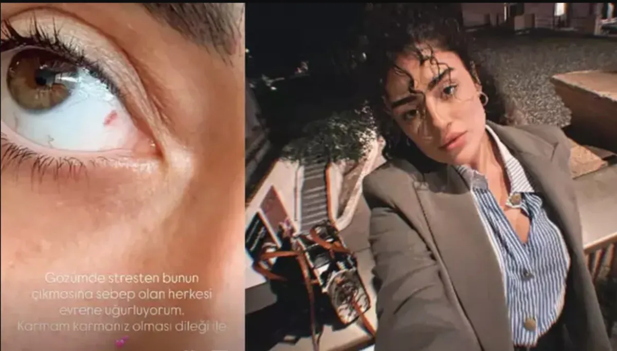 İbrahim Tatlıses'in Kızı Dilan Çıtak'ın Gözüne Ne Oldu