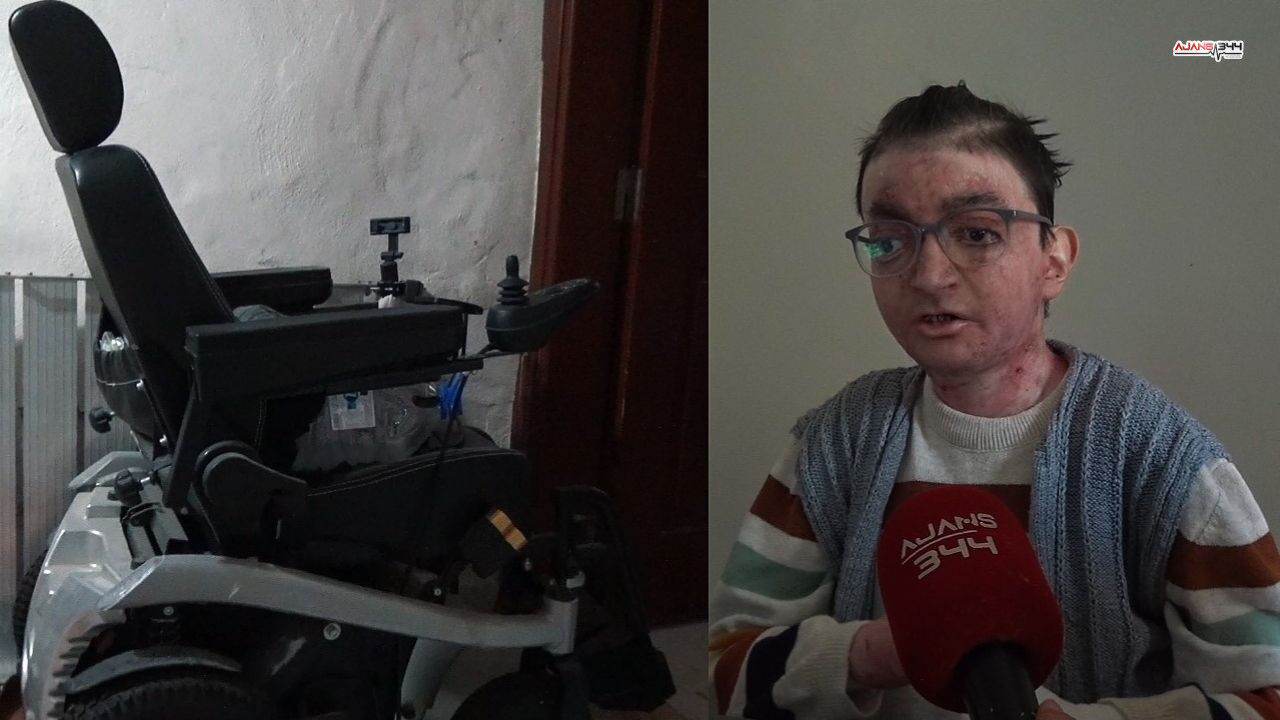 Kelebek Hastası Genç Ajans344 (1)