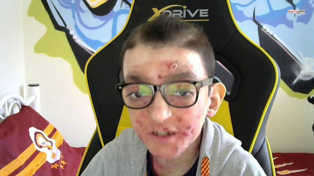 Çicek Hastası Can Gürlek Ajans344 (1)