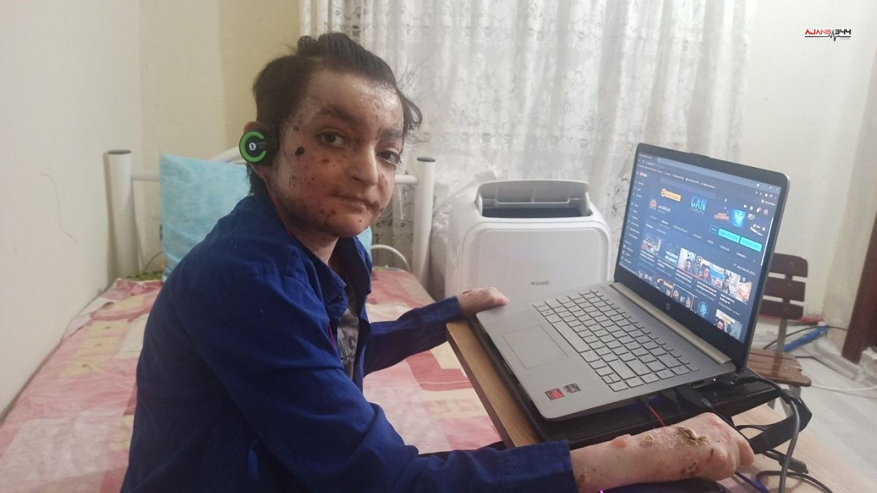 Çicek Hastası Can Gürlek Ajans344