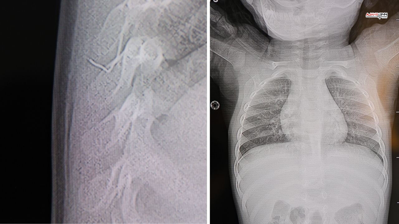 Çıkartılan Tel Ajans344 (1)