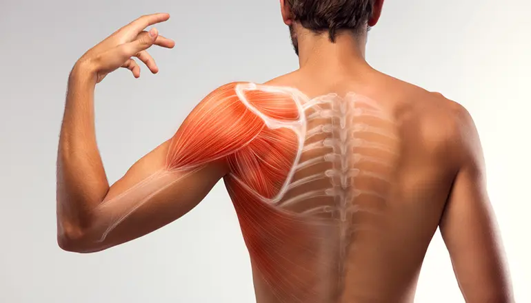 Frozen Shoulder (Donuk Omuz) - Dr Yalın Dirik